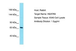 HEATR8 Rabbit anti-Human, Polyclonal, Novus Biologicals 0.1 mL | Buy Online | Novus Biologicals | Fisher Scientific